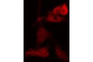 ABIN6274091 staining Hela cells by IF/ICC. (NDC80 anticorps  (C-Term))
