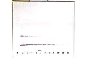 Image no. 5 for anti-Interleukin 1 alpha (IL1A) antibody (ABIN465571) (IL1A anticorps)