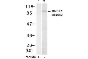 Western blot analysis of extracts from HUVEC cells using p90RSK(Phospho-Ser352) Antibody(Lane 2) and the same antibody preincubated with blocking peptide(Lane1).