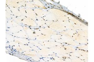 Phospho-Rab8 (Thr72) Antibody at 1/100 staining Rat skin tissue by IHC-P. (RAB8A anticorps  (pThr72))