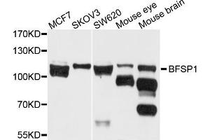 Western blot analysis of extracts of various cell lines, using BFSP1 antibody (ABIN5971950) at 1/1000 dilution. (Filensin anticorps)