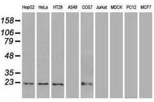 Image no. 2 for anti-Adenylate Kinase 1 (AK1) antibody (ABIN1496515) (Adenylate Kinase 1 anticorps)