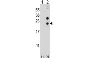 Western Blotting (WB) image for anti-Casein alpha S1 (CSN1S1) antibody (ABIN2997019) (Casein alpha S1 anticorps)
