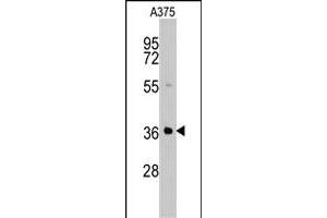 Western blot analysis of AKR1B1 polyclonal antibody  in A-375 cell line lysates (35 ug/lane). (AKR1B1 anticorps  (C-Term))