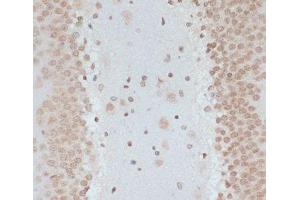 Immunohistochemistry of paraffin-embedded Rat brain using Phospho-p53(S33) Polyclonal Antibody at dilution of 1:100 (40x lens).
