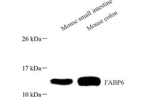 Western blot analysis of FABP6 (ABIN7073921) at dilution of 1: 1000 (FABP6 anticorps)