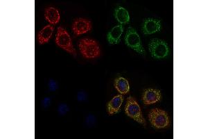 ABIN6258351 and ABIN6275664 staining HepG2 cells by IF/ICC.