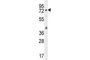 CD31 antibody western blot analysis in mouse bladder tissue lysate