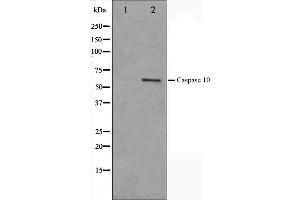 Western blot analysis on HeLa cell lysate using Caspase 10 Antibody,The lane on the left is treated with the antigen-specific peptide. (Caspase 10 anticorps)