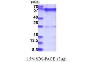 SDS-PAGE (SDS) image for GDP Dissociation Inhibitor 1 (GDI1) (AA 1-447) protein (His tag) (ABIN5853715) (GDI1 Protein (AA 1-447) (His tag))