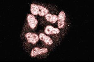 Immunofluorescence staining of HeLa cells (Human cervical epitheloid carcinoma, ATCC CCL-2. (TOPBP1 anticorps  (AA 204-416))