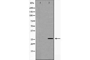 Western blot analysis of extracts of HeLa , using NQO2 antibody.