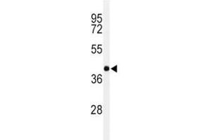Western blot analysis of PAX-6 in Y79 lysate