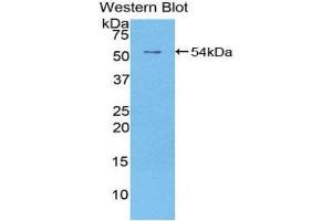 Western Blotting (WB) image for anti-Epidermal Growth Factor Receptor 2 (EGFR2) (AA 376-578) antibody (FITC) (ABIN1175126) (EGFR2 anticorps  (AA 376-578) (FITC))