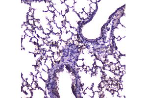 IHC analysis of FABP5 using anti-FABP5 antibody .