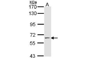 Western Blotting (WB) image for anti-Selectin E (SELE) (AA 278-506) antibody (ABIN467628) (Selectin E/CD62e anticorps  (AA 278-506))