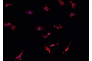 ABIN6276804 staining HepG2? (TAC1 anticorps  (N-Term))