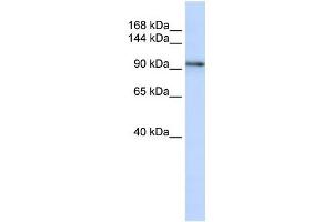 PCDH1 antibody used at 1 ug/ml to detect target protein.