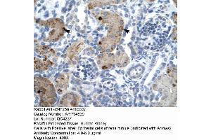 Human kidney (ZMYM6 anticorps  (Middle Region))