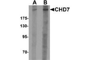 Western blot analysis of CHD7 in SK-N-SH cell lysate with CHD7 antibody at (A) 1 and (B) 2 ug/mL. (CHD7 anticorps  (N-Term))