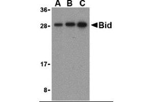 Western Blotting (WB) image for anti-BH3 Interacting Domain Death Agonist (BID) (C-Term) antibody (ABIN1030296) (BID anticorps  (C-Term))