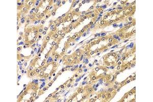 Immunohistochemistry of paraffin-embedded Mouse kidney using UBA3 Polyclonal Antibody at dilution of 1:100 (40x lens). (UBA3 anticorps)
