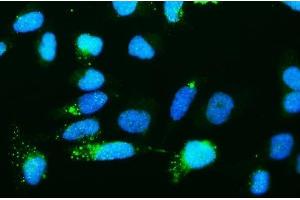 IF analysis of Ribonuclease Inhibitor/RNH1 using anti-Ribonuclease Inhibitor/RNH1 antibody (ABIN7603117). (RNH1 anticorps  (N-Term))