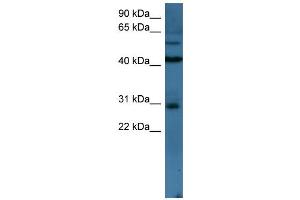 WB Suggested Anti-TLX2 Antibody Titration: 0. (TLX2 anticorps  (N-Term))