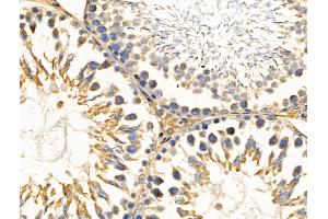 ABIN6256980 and ABIN6274218 at 1/100 staining Rat testis tissue by IHC-P.