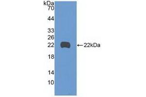 Detection of Recombinant GADD45b, Human using Polyclonal Antibody to Growth Arrest And DNA Damage Inducible Protein Beta (GADD45b) (GADD45B anticorps  (AA 1-160))