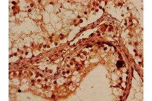 Immunohistochemistry of paraffin-embedded human testis tissue using ABIN7165083 at dilution of 1:100 (PRMT7 anticorps  (AA 285-390))