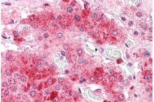 Human Adrenal: Formalin-Fixed, Paraffin-Embedded (FFPE)