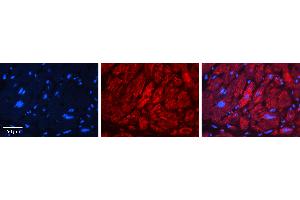 Rabbit Anti-EFEMP1 Antibody   Formalin Fixed Paraffin Embedded Tissue: Human heart Tissue Observed Staining: Cytoplasmic, plasma membrane Primary Antibody Concentration: N/A Other Working Concentrations: 1:600 Secondary Antibody: Donkey anti-Rabbit-Cy3 Secondary Antibody Concentration: 1:200 Magnification: 20X Exposure Time: 0.