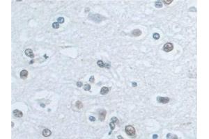 Detection of ILF3 in Human Cerebrum Tissue using Polyclonal Antibody to Interleukin Enhancer Binding Factor 3 (ILF3) (Interleukin enhancer-binding factor 3 (ILF3) (AA 672-891) anticorps)