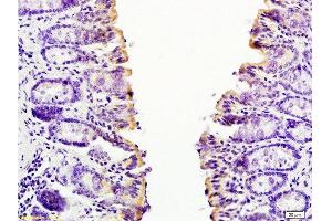 Formalin-fixed and paraffin embedded mouse small intestine tissue labeled with Anti-CCL24 Polyclonal Antibody, Unconjugatedat 1:200 followed by conjugation to the secondary antibody and DAB staining