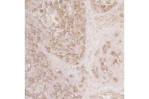 Immunohistochemistry (IHC) image for anti-Actin-Related Protein 2 (ACTR2) (AA 250-300) antibody (ABIN7453465)
