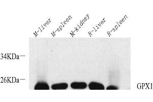 Western Blot analysis of various samples using GPX1 Polyclonal Antibody at dilution of 1:1000. (Glutathione Peroxidase 1 anticorps)