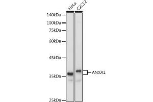 Western blot analysis of extracts of various cell lines, using  antibody (ABIN6133581 and ABIN6136917) at 1:1000 dilution. (Annexin a1 anticorps)