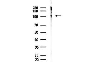 Western blot analysis of lysates from HUVEC cells, using Phospho-Retinoblastoma (Ser780) Antibody at 1/1000 dilution.
