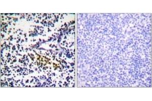 Immunohistochemistry analysis of paraffin-embedded human tonsil tissue, using NYREN18 Antibody. (NUB1 anticorps  (AA 566-615))
