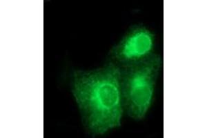 Image no. 2 for anti-Bone Morphogenetic Protein 1 (BMP1) (AA 225-617) antibody (ABIN1491232) (BMP1 anticorps  (AA 225-617))