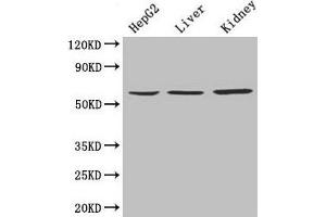 Western Blot Positive WB detected in: HepG2 whole cell lysate, Mouse liver tissue, Mouse kidney tissue All lanes: NAPRT antibody at 4 μg/mL Secondary Goat polyclonal to rabbit IgG at 1/10000 dilution Predicted band size: 58, 61, 57 kDa Observed band size: 58 kDa (NAPRT1 anticorps  (AA 1-310))