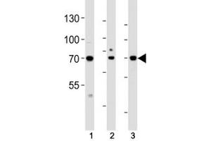Western blot analysis of lysate from (1) HeLa, (2) HepG2 and (3) human placenta tissue lysate using ATF6 beta antibody at 1:1000.