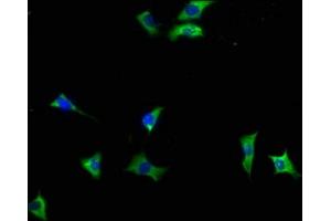 Immunofluorescence staining of SH-SY5Y cells with ABIN7140040 at 1:133, counter-stained with DAPI. (INPP5F anticorps  (AA 187-204))
