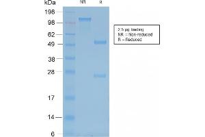 SDS-PAGE Analysis Purified Neurofilament Mouse Recombinant Monoclonal Antibody (rNF421).