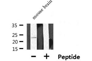 Western blot analysis of extracts from Mouse brain lysate, using PEBP1 antibody. (PEBP1 anticorps  (C-Term))