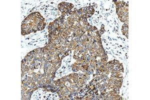 IHC analysis of SERCA3/ATP2A3 using anti-SERCA3/ATP2A3 antibody (ABIN3043794).