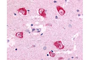 Anti-PAK7 antibody IHC of human brain, thalamus neurons. (PAK7 anticorps  (Internal Region))