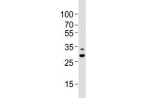 Western blot analysis of lysate from A431 cell line using PHB antibody diluted at 1:1000. (Prohibitin anticorps  (N-Term))
