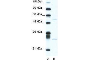 WB Suggested Anti-ATF4 Antibody Titration:  5. (ATF4 anticorps  (C-Term))